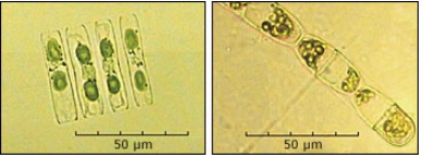 Phytoplankton microscope