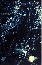 Diatoms silicate covering