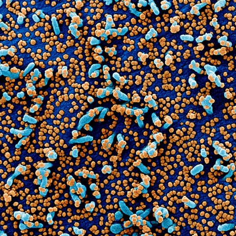 Colorized scanning electron micrograph of a VERO E6 cell (blue) heavily infected with SARS-COV-2 virus particles (orange), isolated from a patient sample. Image captured and color-enhanced at the National Institute of Allergy and Infectious Diseases Integrated Research Facility in Fort Detrick, Maryland.