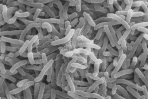 Vibrio cholerae—the bacteria that cause cholera—can live in the guts of microscopic aquatic animals and can lurk in the ocean for months to years. When the right environmental conditions arise, the bacteria can infiltrate water supplies and spread disease to people. (Scanning electron microscope image courtesy of Kirn et al., Dartmouth Medical School, via Wikimedia Commons.)